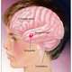 Image for article titled It's Official: Vaccines Don't Cause Autism